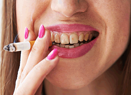 Woman smoking with dirty teeth